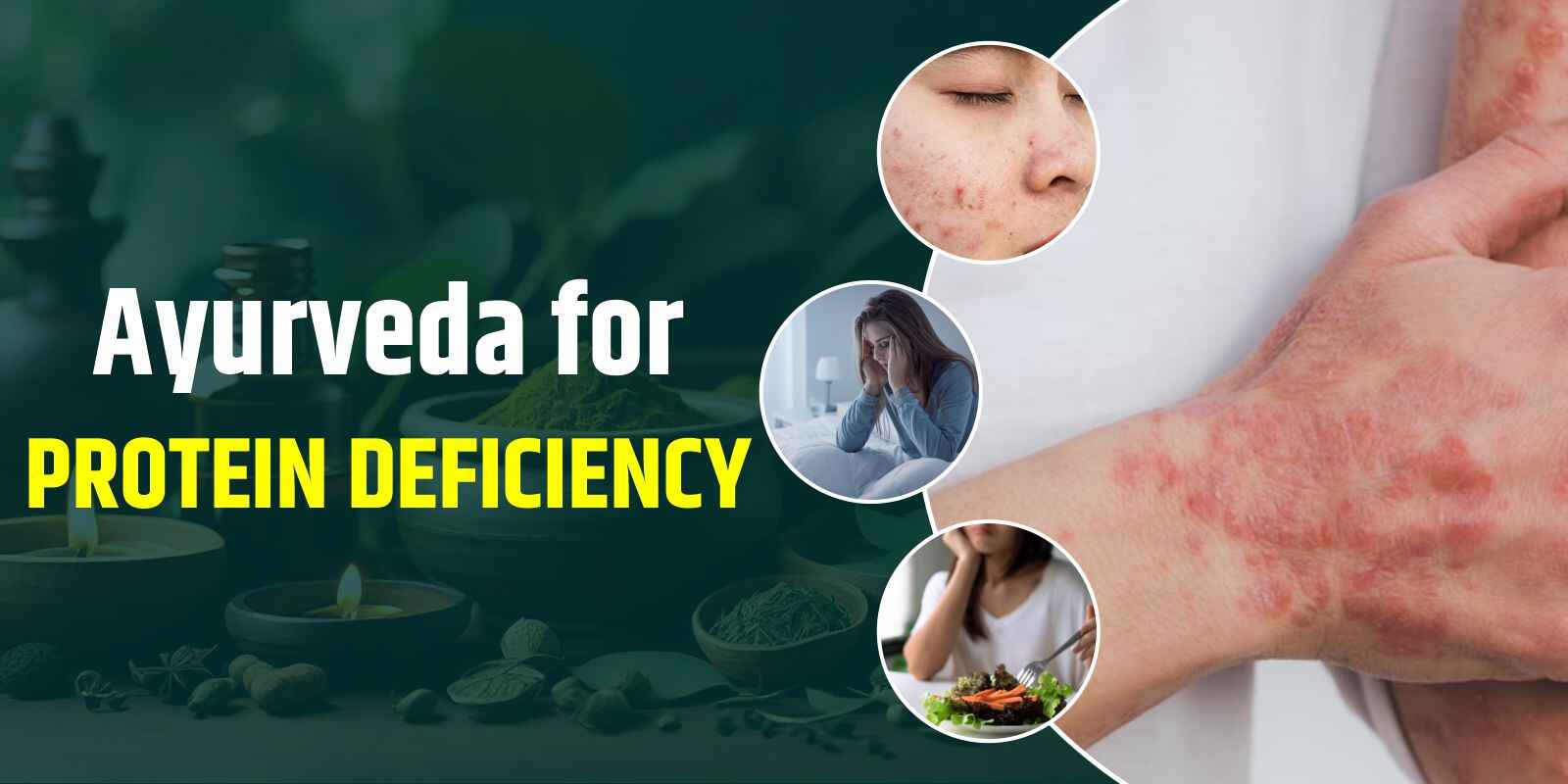 Ayurveda for Protein Deficiency